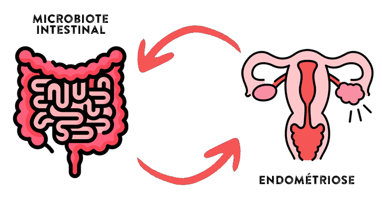 Comment soulager l'endométriose